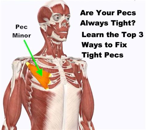 pectoralis minor pain symptoms